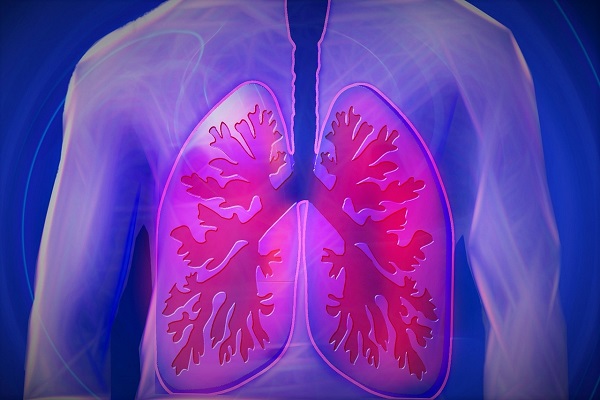 Enfermedad pulmonar
