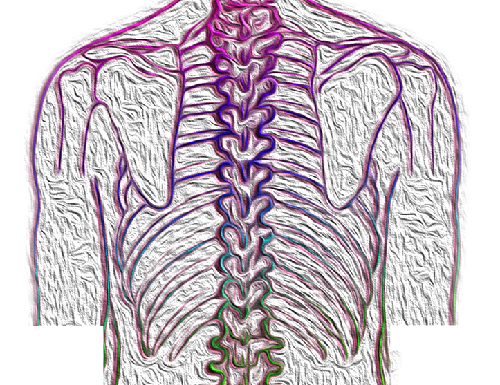 Taller de patologia Lumbar