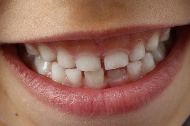 Higiene dental - Mazarrón